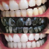 Ervaring met Diamond Smile tandbleekpoeder - mond met voor en na foto van witte tanden